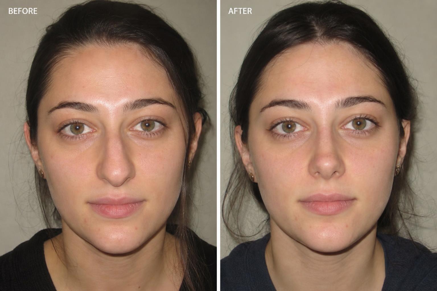 Before and after — Aesthetic & Reconstructive Surgery